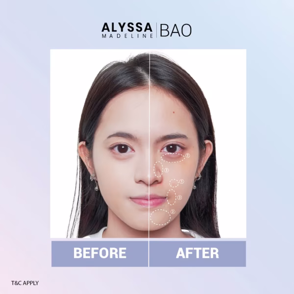 E-COMMERCE-06 Comparison of woman's face before and after treatment.